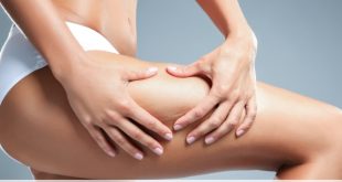 Differenza tra cellulite e ritenzione idrica