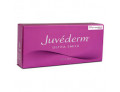 Juvederm Ultra Smile Filler intradermico (2 siringhe da 0.55 ml ciascuna)